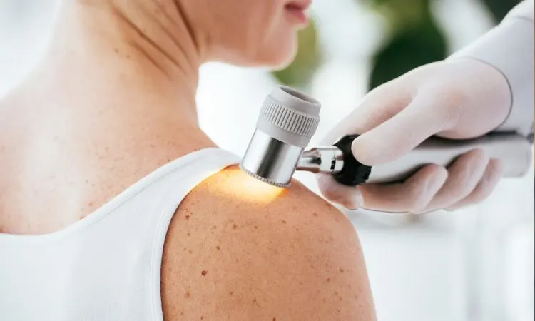 Dermatólogo Guayaquil Dermatólogo Guayaquil Norte